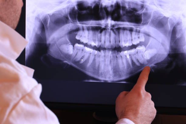 Best Knocked-Out Tooth Emergency  in Picture Rocks, AZ
